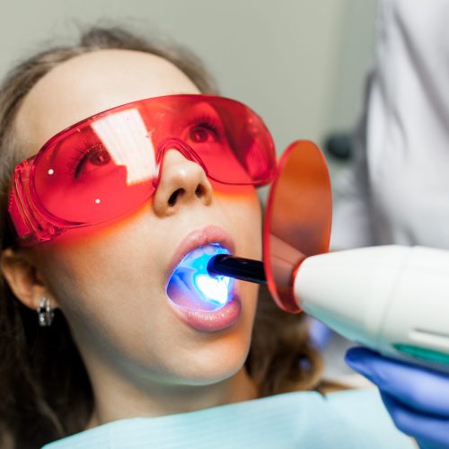 canal-de-cadeira-de-cadeira-de-beleza-caries-de-beleza