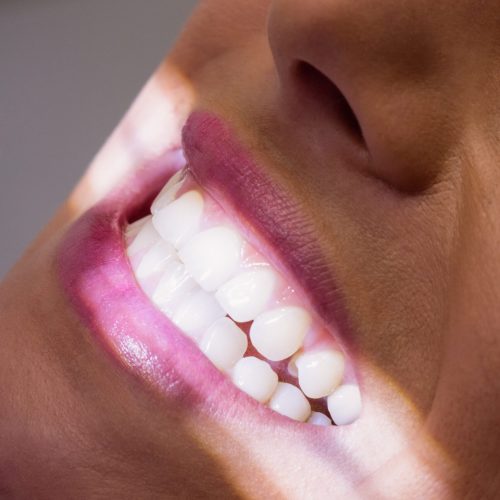 Close-up of female patient receiving a dental treatment at clinic
